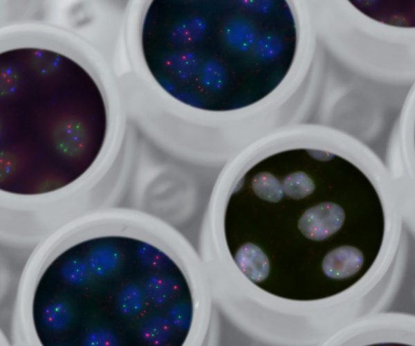 national-cancer-institute-bwMhq_itmMU-unsplash